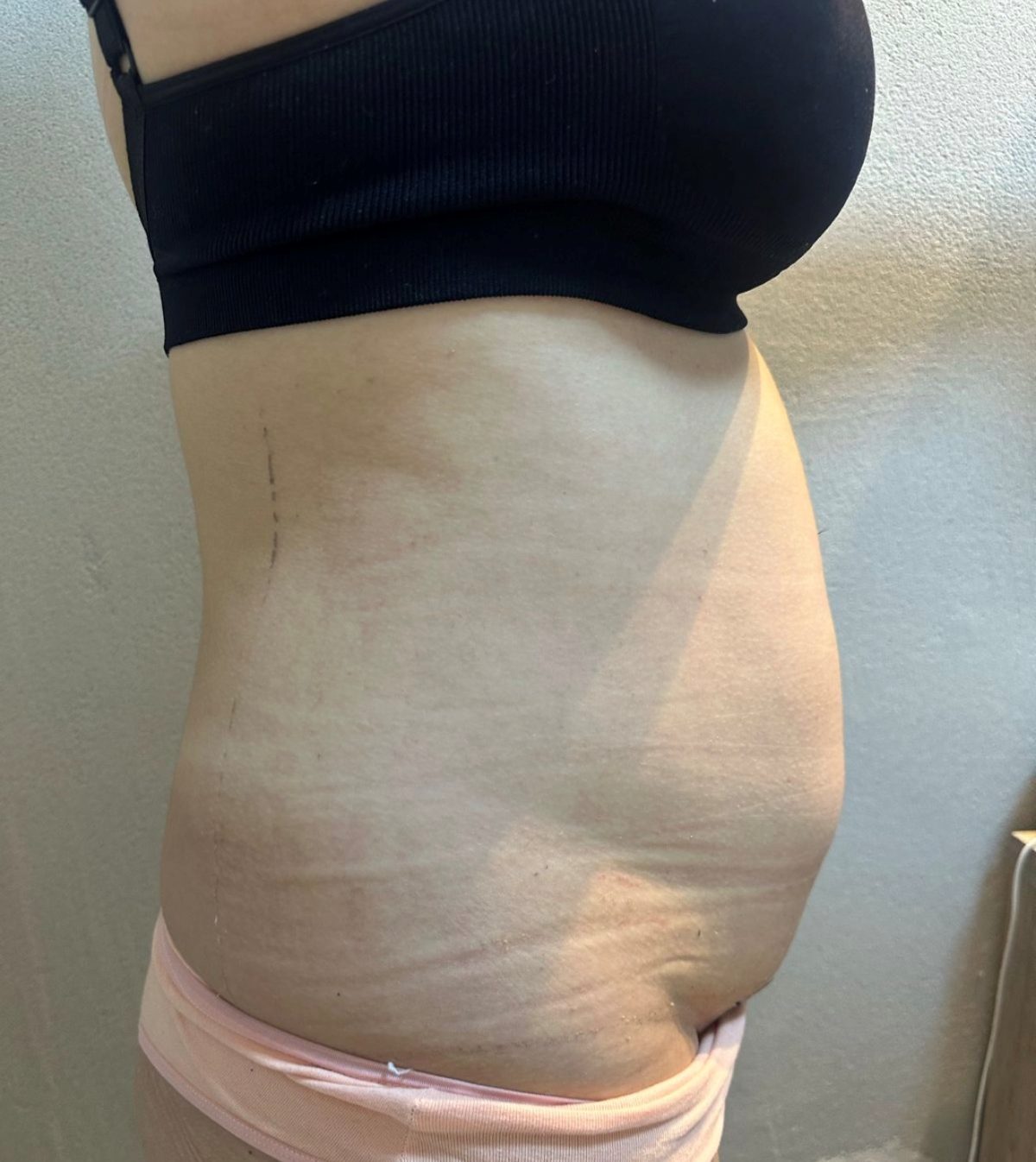 Evolução clínica 2 — depois do acompanhamento